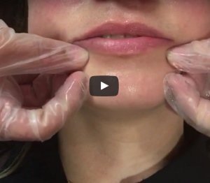 Massage - Secret to Beautiful Lip Fillers | Clinicbe London