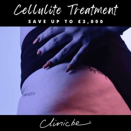 cellulite special offer