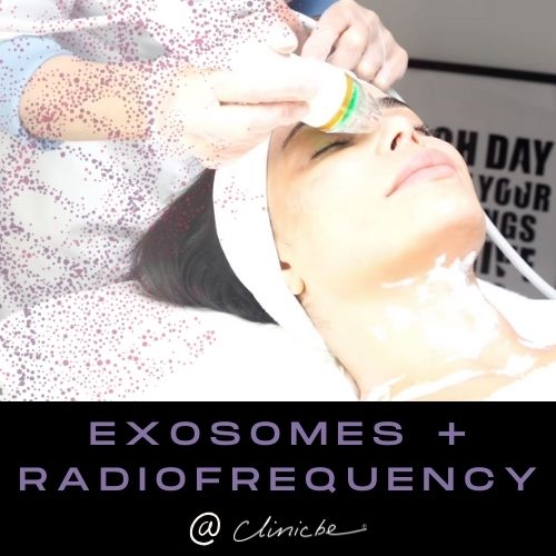 Exosomes with Radiofrequency - Exclusive Combination Treatment